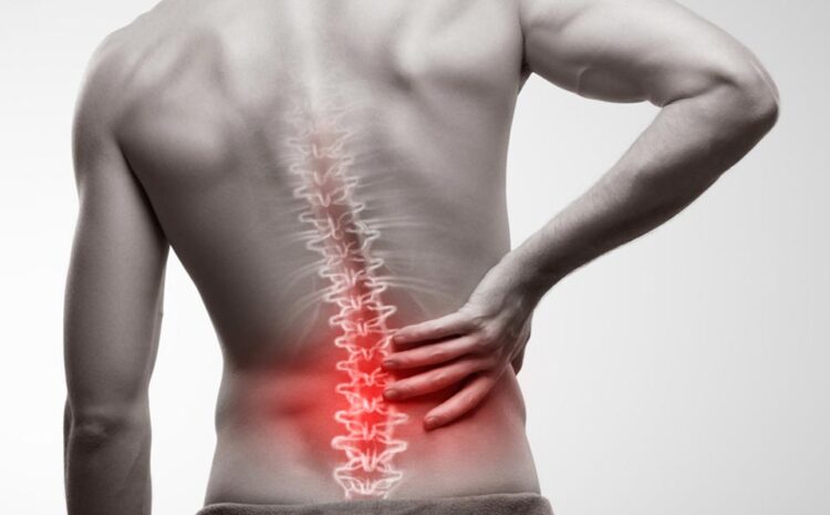  Low Back Pain Management
