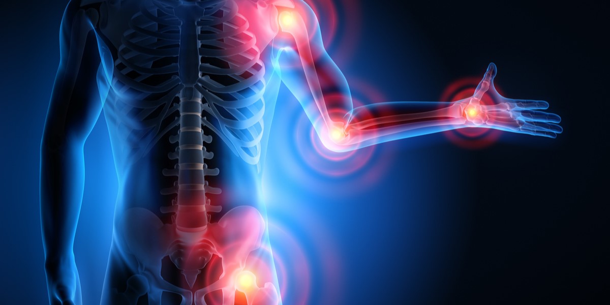 what-is-arthritis-principle-physiotherapy-chelmsford-essex